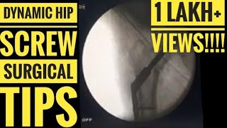 DHS (Dynamic Hip Screw) for Intertrochanteric Hip Fracture (HD Video of Surgical Tips and Tricks)