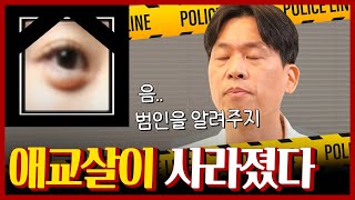 하안검 수술하면 '애교살' 없어지는 거 알고 계셨나요?