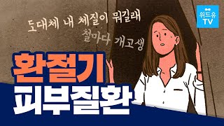 계절이 바뀌면 심해지는 아토피 피부질환! 기온이나 주변환경, 체질에 영향을 받지는 않나요?