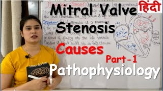 Mitral Valve Stenosis in Hindi | Definition | Causes| Pathophysiology | Part-1