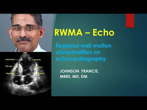 Rwma Echo Youtube