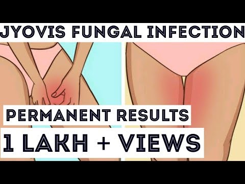 NO MORE FUNGAL INFECTION | HOW TO GET RID OF ANY SKIN INFECTION |BestHacks| Dr. Raj Satpute | JYOVIS NO MORE FUNGAL INFECTION | HOW TO GET RID OF ANY SKIN INFECTION |BestHacks| Dr. Raj Satpute | JYOVIS