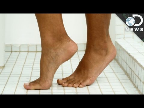 What Causes Warts? What Causes Warts?