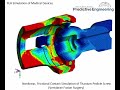 fea simulation of medical devices using advanced nonlinear analysis