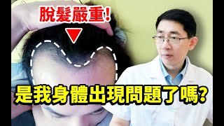 【脫髮治療】脫髮嚴重與身體健康情況有關係嗎？雄激素脫髮如何治療？丨植髮醫生李丙雙