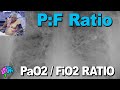 PaO2 to FiO2 Ratio - PF Ratio