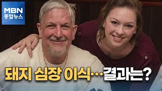 사람 몸에 유전자 조작 돼지 심장 첫 이식…\