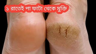 শীতকালে পা ফাটা দূর করার সহজ উপায় || জীবনে কোনো দিনও পায়ের গোড়ালি ফাটবে না ||