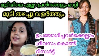 മുടിയിലെ കൊഴിച്ചിൽ, താരൻ, അകാല നര എല്ലാം മാറ്റി കരുത്തോടെ മുടി വളർത്താൻ ഈ തരികൾ മതി|#awesome