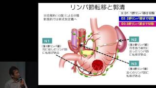 胃癌治療ガイドラインの歴史と今後 “世界をリードする日本の胃癌治療とガイドラインの経緯”　円谷 彰