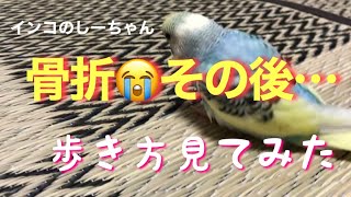 骨折その後…回復の様子を歩き方で見てみた