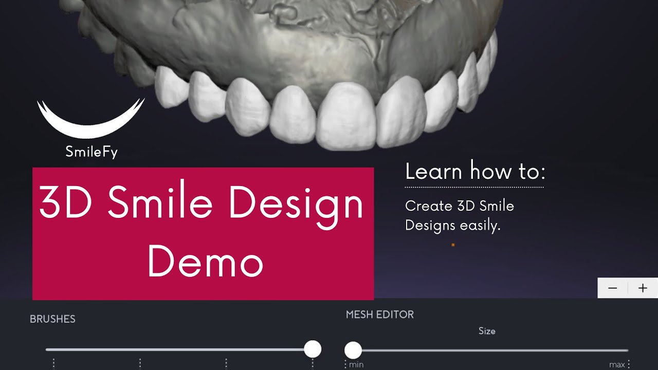 SmileFy 3D Smile Design Demo - YouTube