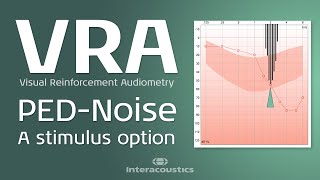 Pediatric Noise: Theoretical Introduction