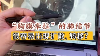 有血管穿行、胸膜牵拉的肺结节，就很危险？也有观察不变化的