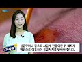 추석 벌초 벌초시기 와 벌초 주의할 점 벌초 예초기 벌초작업 유의사항 예초기 사용할때 주의사항 말벌에 물렸을때 대처 뱀에 물렸을때