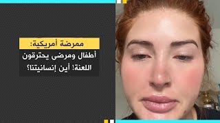 ممرضة أمريكية: أطفال ومرضى يحتـ.ـرقـ.ـون اللعـ.ـنة! أين إنسانيتنا؟