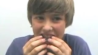 Zero-G Mouthguard Custom Fitting Tutorial for Braces