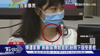 不忍了! 傳遭男友暴打成傷 高嘉瑜提告傷害｜TVBS新聞