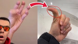 ONLY 1% Of People Can Do This With Both Thumbs..👽