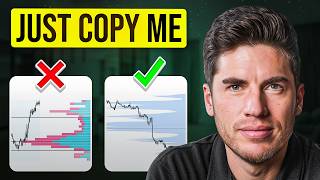 The Secret Behind Volume Profiles (Nobody Talks About)