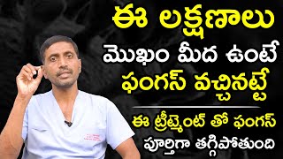 ఈ లక్షణాలు మొఖం మీద ఉంటే ఫంగస్ వచ్చినట్టే. ఈ ట్రీట్మెంట్ తో తగ్గిపోతుంది | Dr. Anjaneyulu | HQ