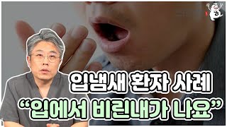 입에서 비린내가 나는 입냄새 환자 사례