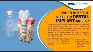 State-of-the-art Dental Healthcare Services | Oral Healthcare | HCL Healthcare onsite Dental Clinics