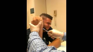 Boxers fracture pin removal