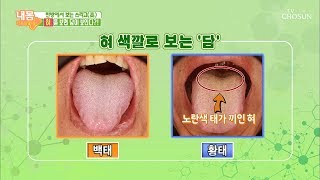 혀를 보면 담이 보인다! 혀의 모양과 색깔로 보는 건강 [내 몸 사용설명서] 256회 20190614