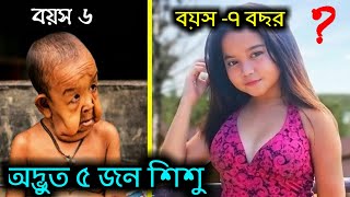 পৃথিবীর সবচেয়ে আজব ও অদ্ভুত ৫ জন শিশু👶। 5 most unusual kids in the world.