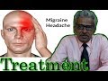 Migraine Headache Treatment in Homeopathy by Dr. P.S. Tiwari