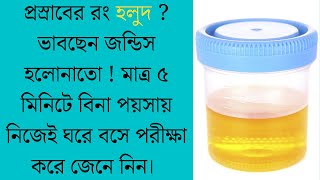 কি কি কারনে প্রস্রাবের রঙ গাঢ় হলুদ হয়? জন্ডিস রোগে?  নিজেই পরীক্ষা (বিলুরুবিন টেস্ট) করে জেনে নিন