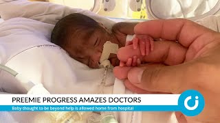 Progress of premature baby amazes doctors