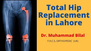 Best Total Hip Replacement in Lahore Pakistan, Dr. Muhammad Bilal Senior Joint Replacement Surgeon.