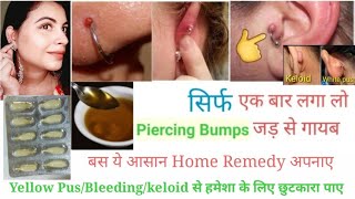 Piercing bumps गायब करने का आसान व घरेलू उपाय ll New Piercing मे Pus/Bleeding/keloid कभी नही होगा l