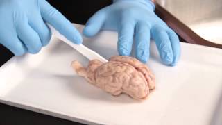 Carolina Quick Tip®: Sheep Brain Dissection
