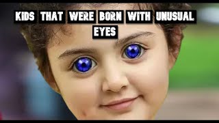 Kids That Were Born with Unusual Eyes
