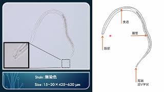 【「寄生虫かるた」豆構造解説】No.8 糞線虫 第3期幼虫