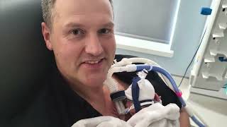 Robin Alcock’s 125 Day Journey In 11 Minutes. Born At 25 weeks.