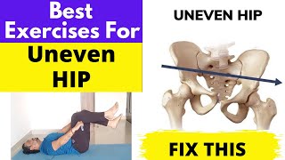 Best Exercises For UNEVEN HIP | Hip Imbalance Correction Exercises | High Hip Correction