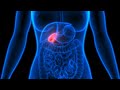 Have You Had Your Gallbladder Removed – Now what?  With Dr. Justine and Dr. Udani