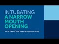 How to Manage a Narrow Mouth Opening During a Difficult Airway Intubation