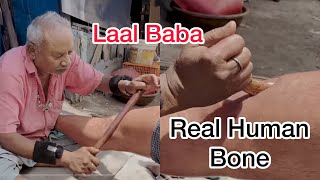 Laal Baba Bone Stick Massage and Smokey Oil to observe the Pain  ASMR Laal Baba (Smoke Master)