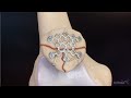 Patella Fracture Repair Using the Arthrex Mesh Plating System