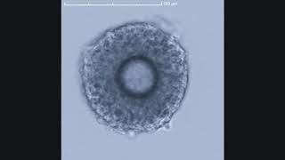 Plankton Diversity as observed with the Cytosense flow cytometer