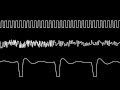 c64 rob hubbard s ace ii title music oscilloscope view