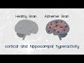 disruption of inhibition in alzheimer s disease