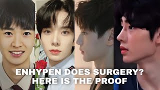 Enhypen does plastic surgery?