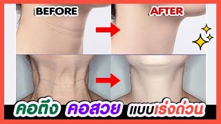 NECK REJUVENATION EXERCISE | Neck Tightening, Fix Neck Wrinkles \u0026 Saggy Neck, Neck Lift, Aging Neck