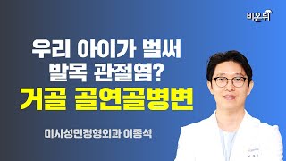 우리 아이가 벌써 발목 관절염? - 거골 골연골병변 / 미사성민정형외과 이종석